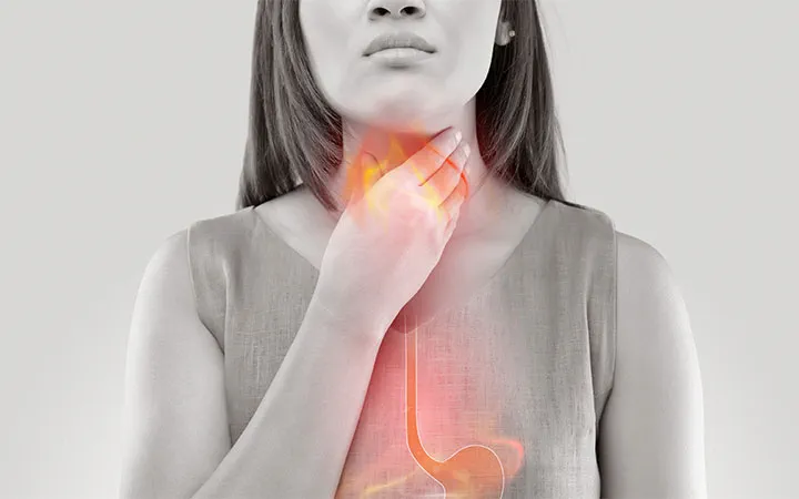 Read more about the article How Acid Reflux Erodes the Teeth and 10 Ways to Protect It