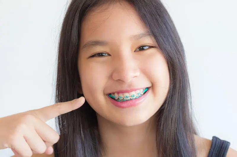 You are currently viewing Getting Braces With Wisdom Teeth: What You Need to Know Beforehand