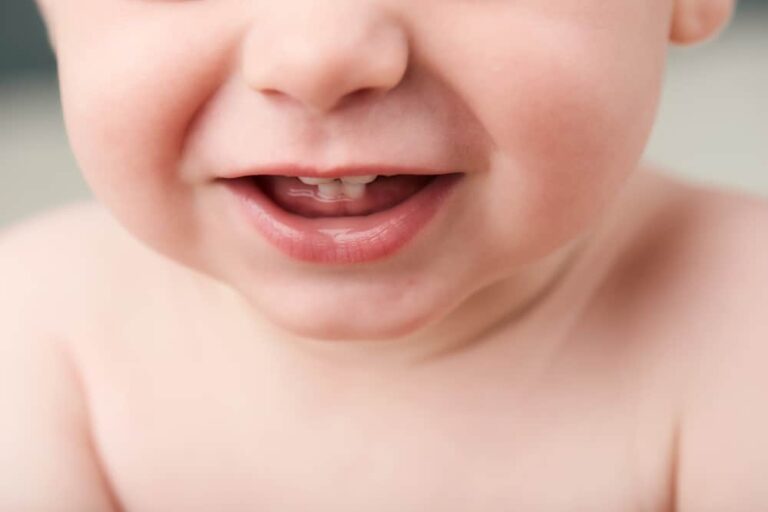 Why Does My Baby Teeth Look Discolored or Gray? Teethandtooth