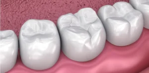 Read more about the article All You Need to Know About Deep Grooves in Teeth