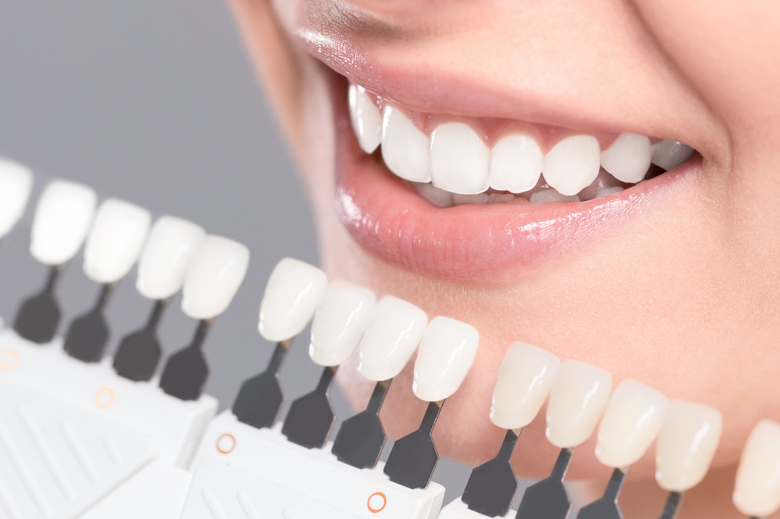 You are currently viewing Why Won’t My Teeth Whiten? All You Need to Know About Teeth Whitening
