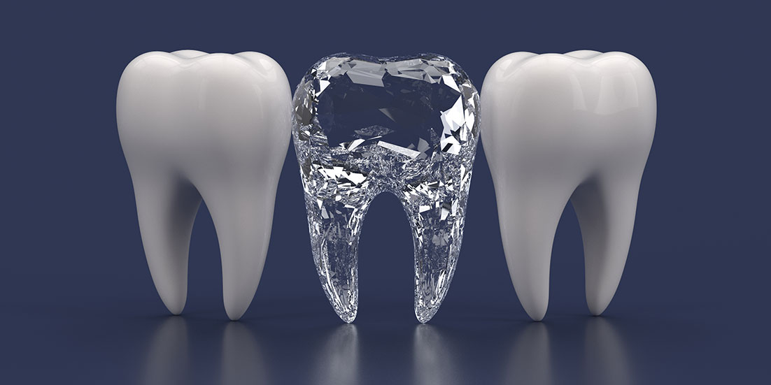 You are currently viewing All You Need to Know About Diamond Tooth Dental Implants