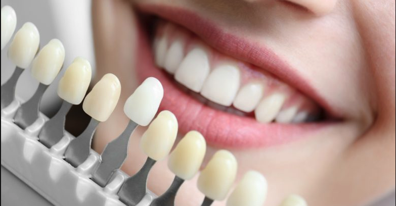 Read more about the article Is It True That Your Are Teeth Supposed to Be White?