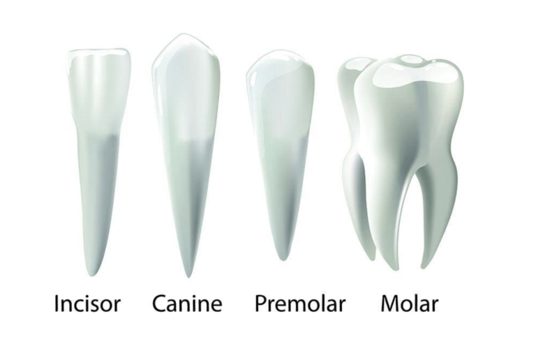 How Many Roots Do Wisdom Teeth Have and Why It Matters - Teethandtooth