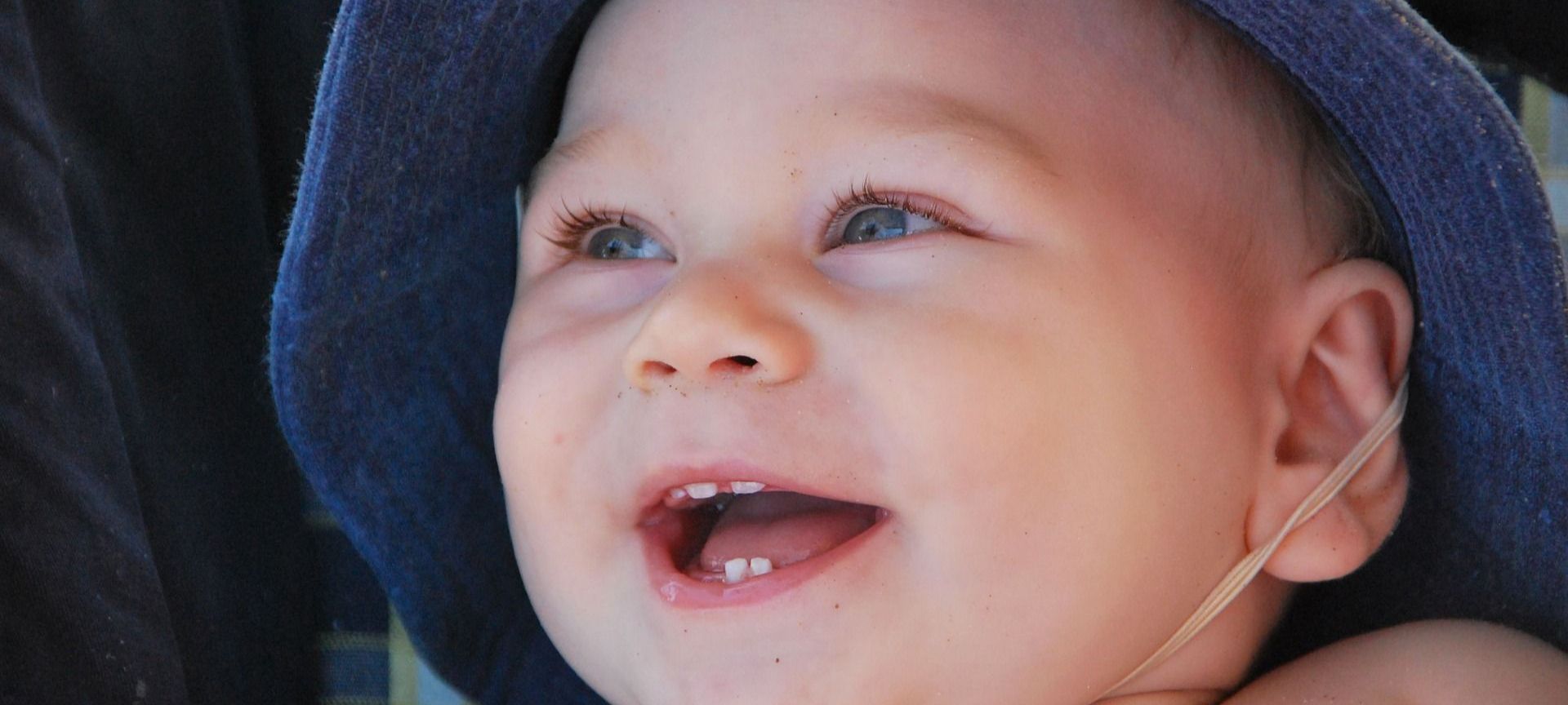 Read more about the article 5 Things to Do When Baby Has Gap in Front Teeth